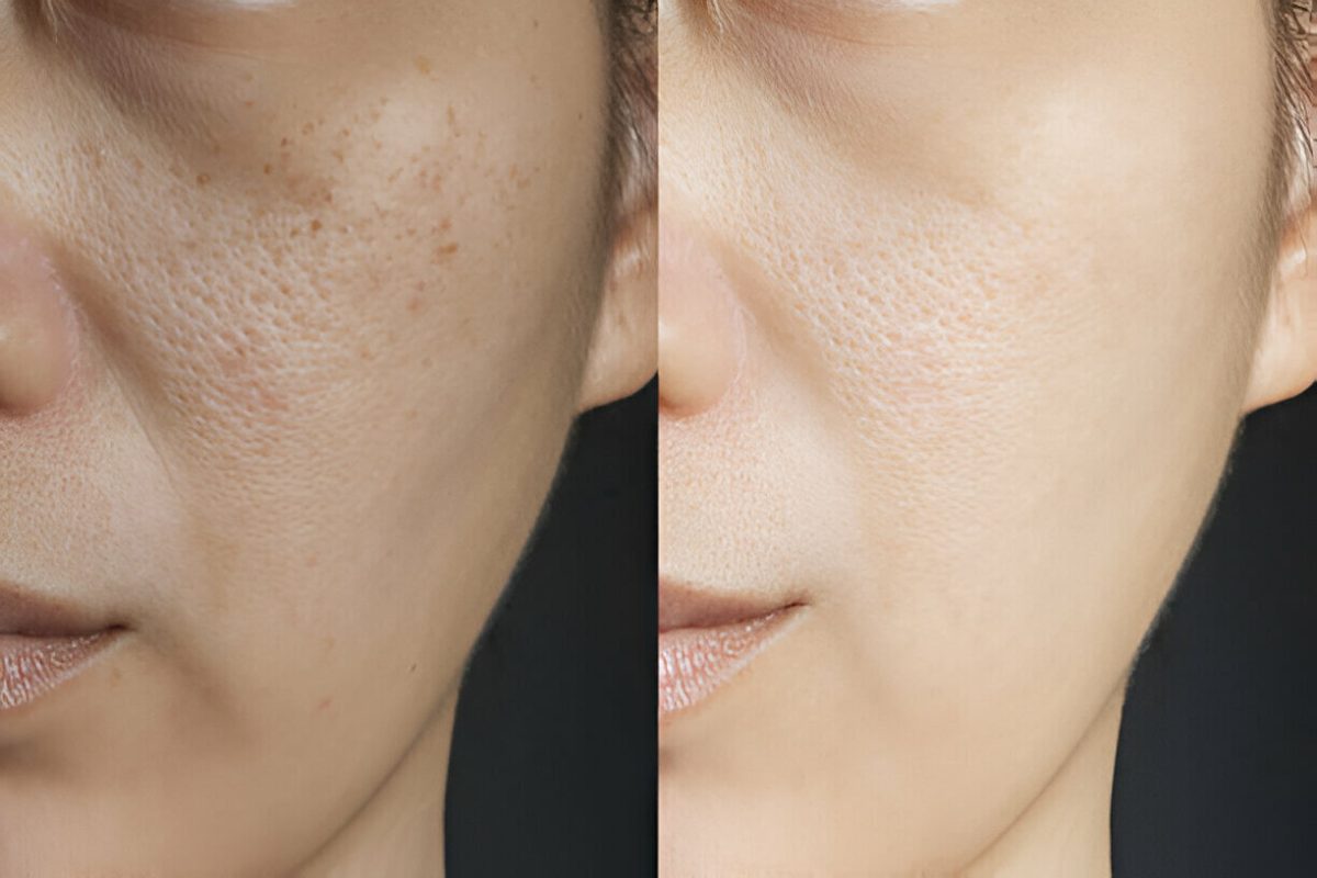 Benefits of Regular Facial